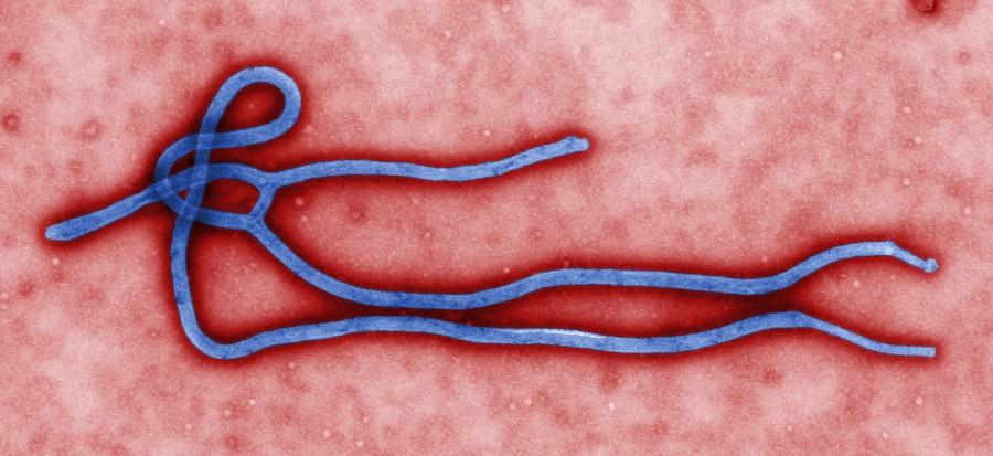 Ebola: What We Need to Know